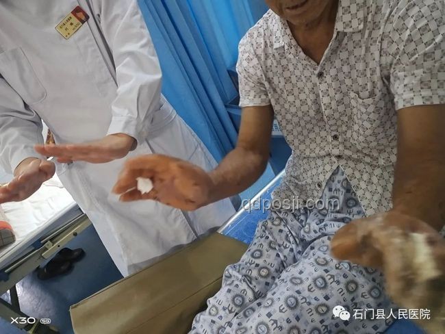 三亚被咬女子案：了解神经毒蛇咬伤知识